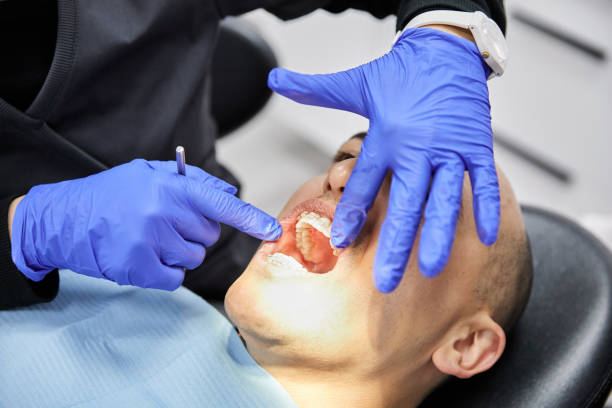Best Broken or Chipped Tooth Repair in Vaughn, WA